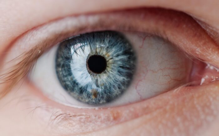 Depósito de proteínas nas lentes de contato: o que é, e como resolver?