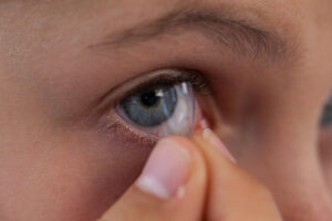 Lentes de Contato: Como colocar, retirar e cuidar das suas!