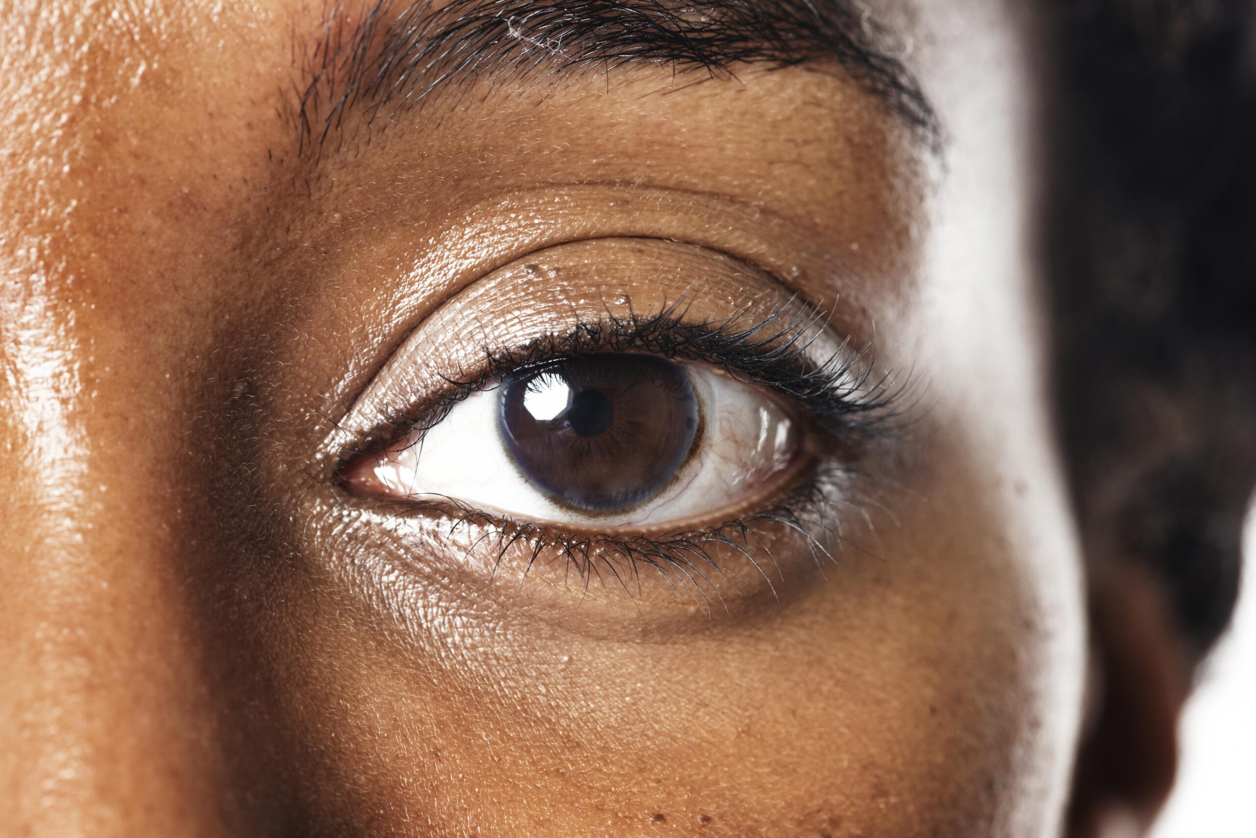 lentes de contato grudam nos olhos 
