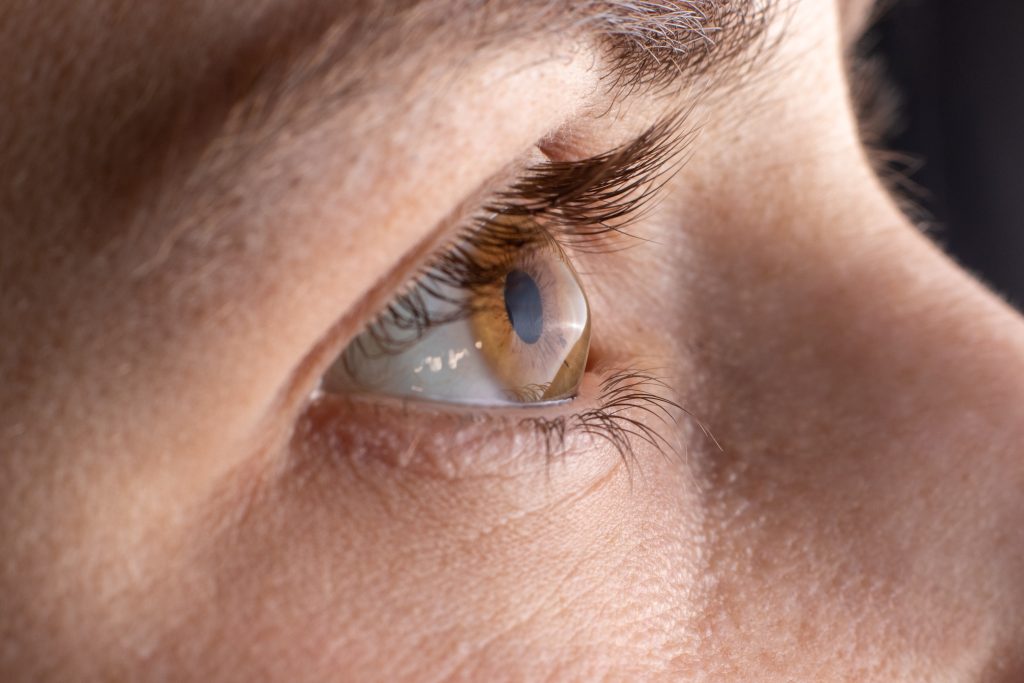 lentes de contato